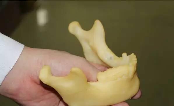 3D打印技术也能用来救治疑难杂症？