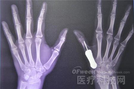 OFweek可穿戴设备网
